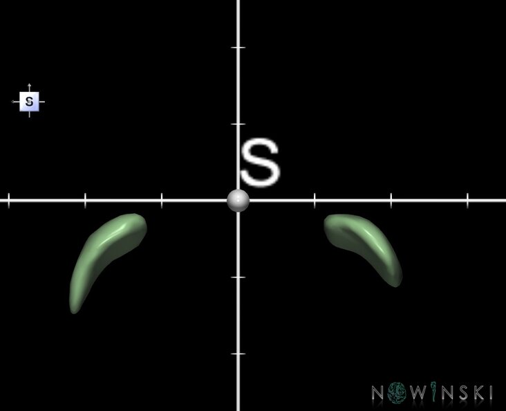 G1.T11.6.1.V5.C2.Ss.L0.Globus_pallidus_medial_segment.tiff