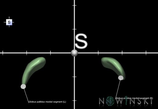 G1.T11.6.1.V5.C2.Ss.L1.Globus pallidus medial segment