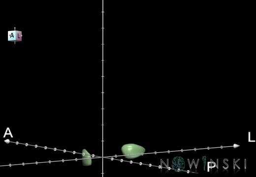 G1T11.6.StereotacticTargets