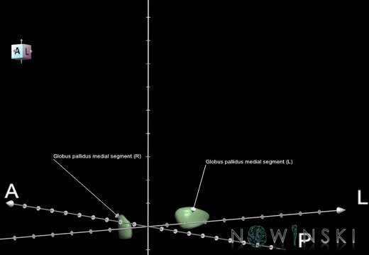 G1.T11.6.1.V7.C2.Ss.L1.Globus pallidus medial segment