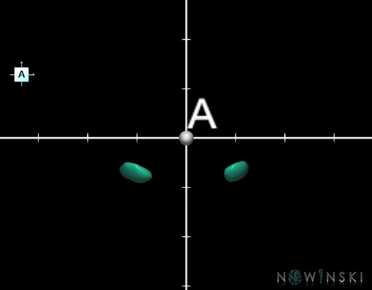 G1.T11.6.2.V1.C2.Ss.L0.Subthalamic_nucleus.tiff