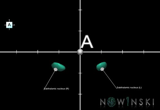 G1.T11.6.2.V1.C2.Ss.L1.Subthalamic nucleus