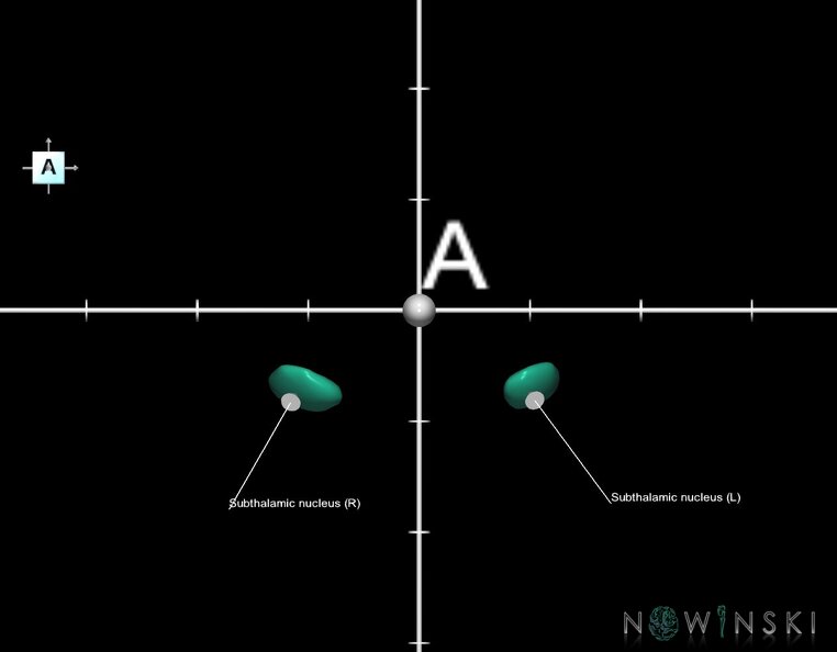 G1.T11.6.2.V1.C2.Ss.L1.Subthalamic_nucleus.tiff