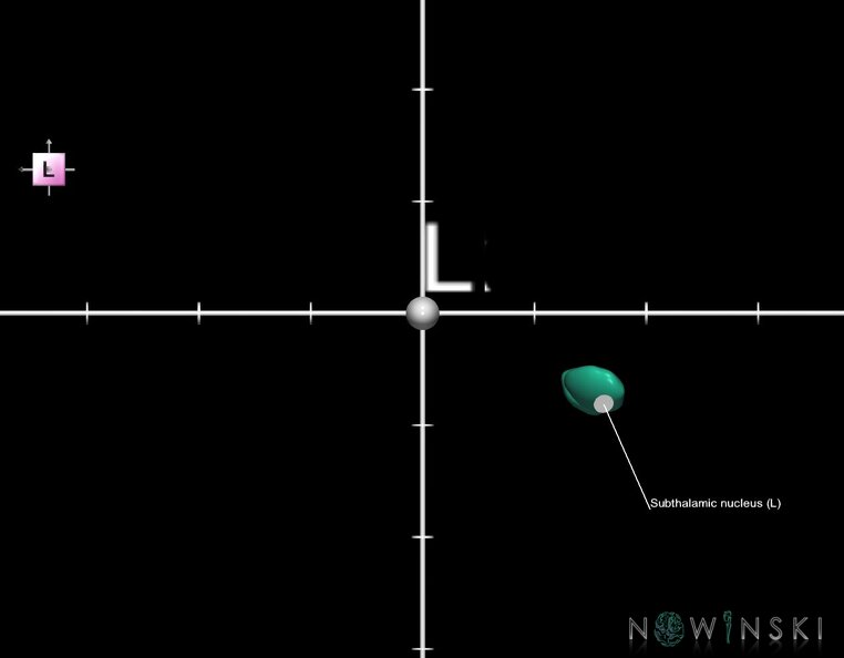 G1.T11.6.2.V2.C2.Ss.L1.Subthalamic_nucleus.tiff