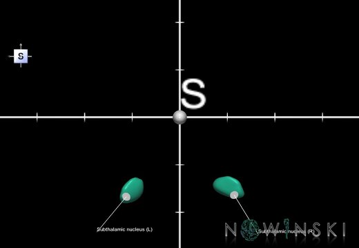 G1.T11.6.2.V5.C2.Ss.L1.Subthalamic nucleus