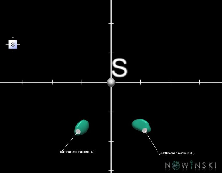 G1.T11.6.2.V5.C2.Ss.L1.Subthalamic_nucleus.tiff