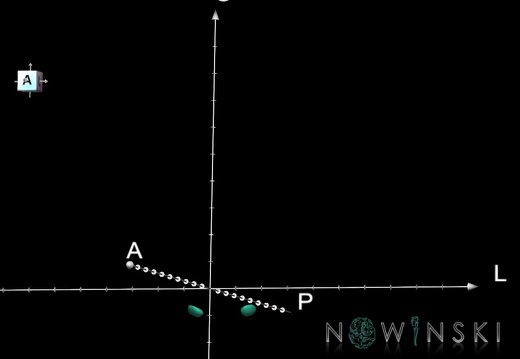 G1T11.6.StereotacticTargets
