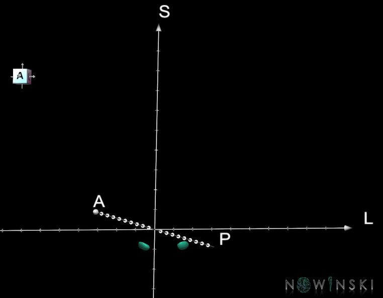 G1.T11.6.2.V7.C2.Ss.L0.Subthalamic_nucleus.tiff