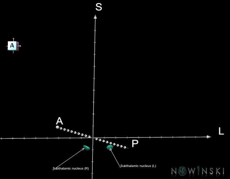 G1.T11.6.2.V7.C2.Ss.L1.Subthalamic_nucleus.tiff