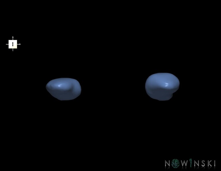 G1.T11.7.V6.C2.L0.Amygdala.tiff