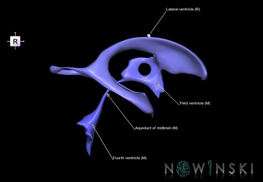 G1T12.CerebralVentricles