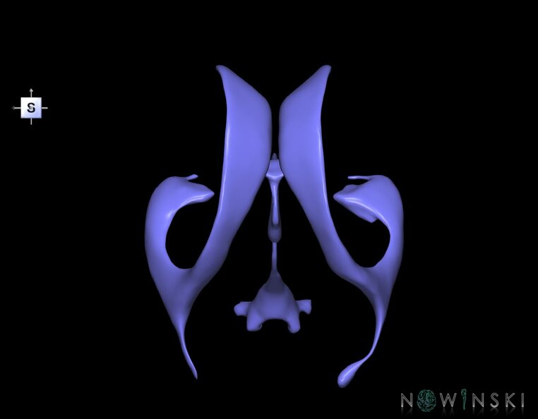 G1.T12.V5.C1.L0.Cerebral_ventricles.tiff
