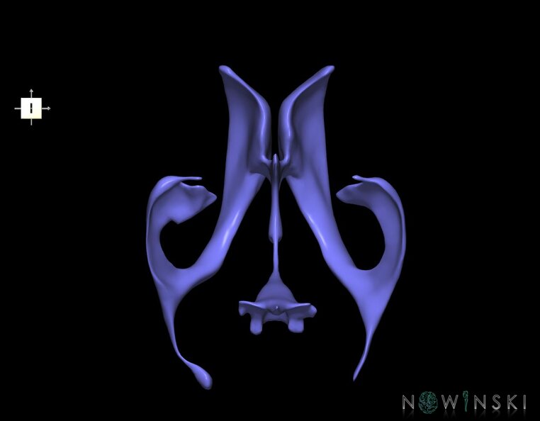 G1.T12.V6.C1.L0.Cerebral_ventricles.tiff