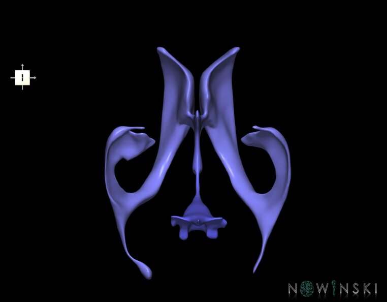 G1.T12.V6.C2.L0.Cerebral_ventricles.tiff