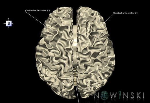 G1.T13.1.V5.C2.L1.White matter whole