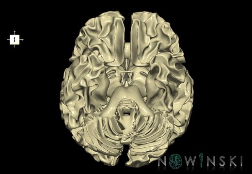 G1.T13.1.V6.C1.L0.White matter whole