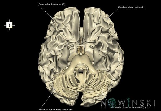 G1.T13.1.V6.C2.L1.White matter whole