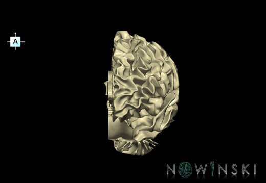 G1.T13.2.V1.C1.L0.White matter left