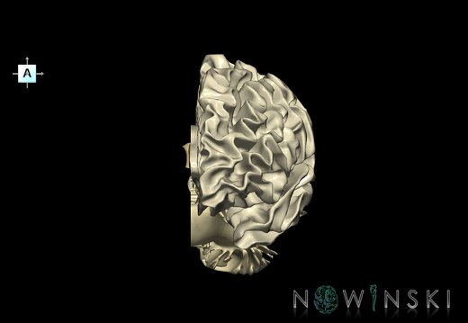 G1.T13.2.V1.C2.L0.White matter left