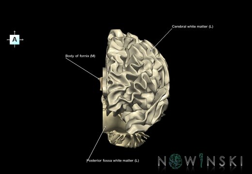 G1.T13.2.V1.C2.L1.White matter left