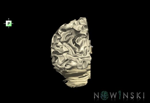 G1.T13.2.V3.C2.L0.White matter left