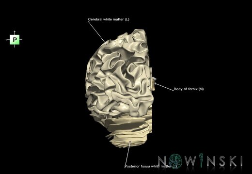 G1.T13.2.V3.C2.L1.White matter left