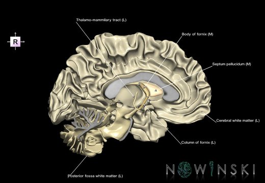 G1.T13.2.V4.C2.L1.White matter left