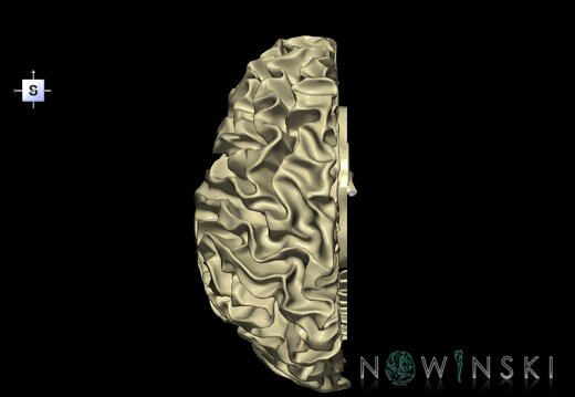 G1.T13.2.V5.C1.L0.White matter left