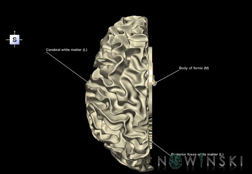 G1.T13.2.V5.C2.L1.White matter left