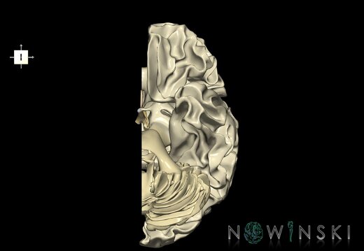 G1.T13.2.V6.C2.L0.White matter left