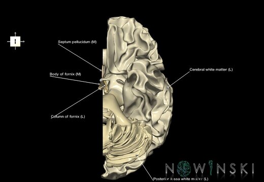 G1.T13.2.V6.C2.L1.White matter left