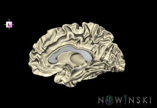 G1.T13.4.V2.C2.L0.Cerebral white matter right