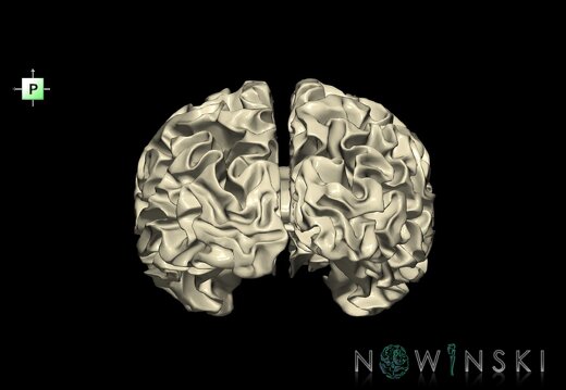 G1.T13.4.V3.C2.L0.Cerebral white matter