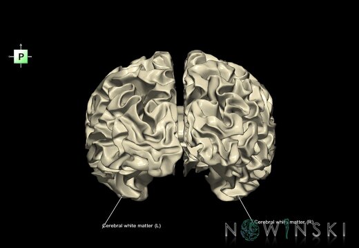 G1.T13.4.V3.C2.L1.Cerebral white matter