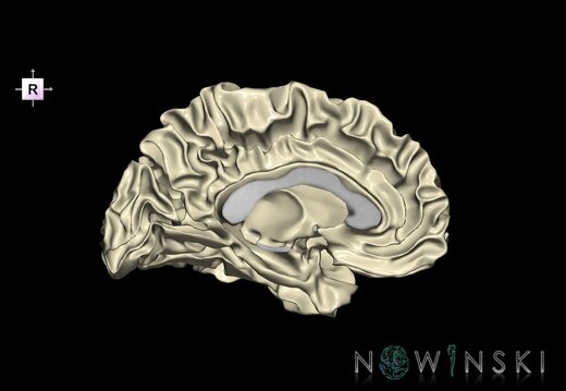 G1.T13.4.V4.C2.L0.Cerebral white matter left