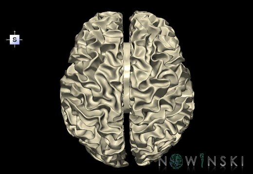 G1.T13.4.V5.C2.L0.Cerebral white matter