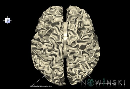 G1.T13.4.V5.C2.L1.Cerebral white matter