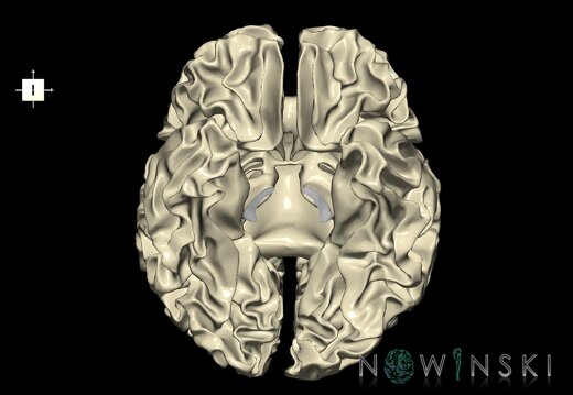 G1.T13.4.V6.C2.L0.Cerebral white matter