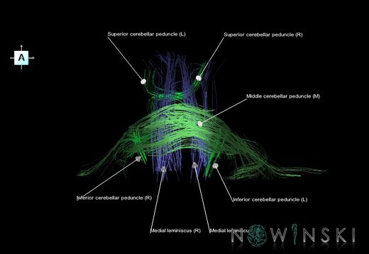 G1.T14.5.V1.C2.L1.Posterior fossa tracts