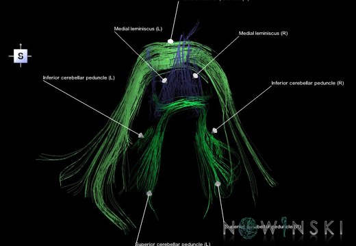 G1.T14.5.V5.C2.L1.Posterior fossa tracts