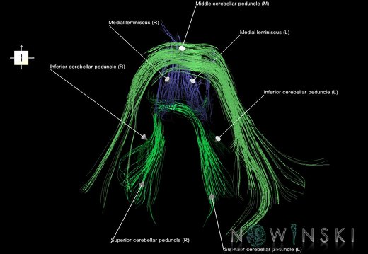 G1.T14.5.V6.C2.L1.Posterior fossa tracts