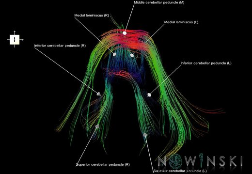 G1.T14.5.V6.C5.L1.Posterior fossa tracts