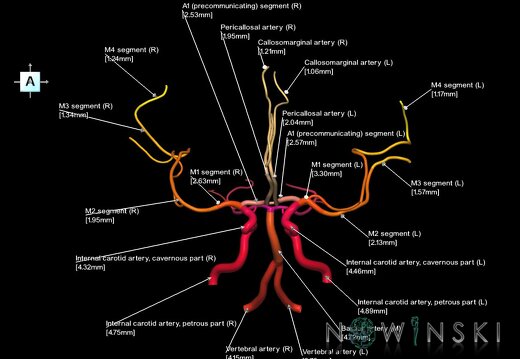 G1.T15.1.V1.C2.L3.Intracranial arterial system main branches