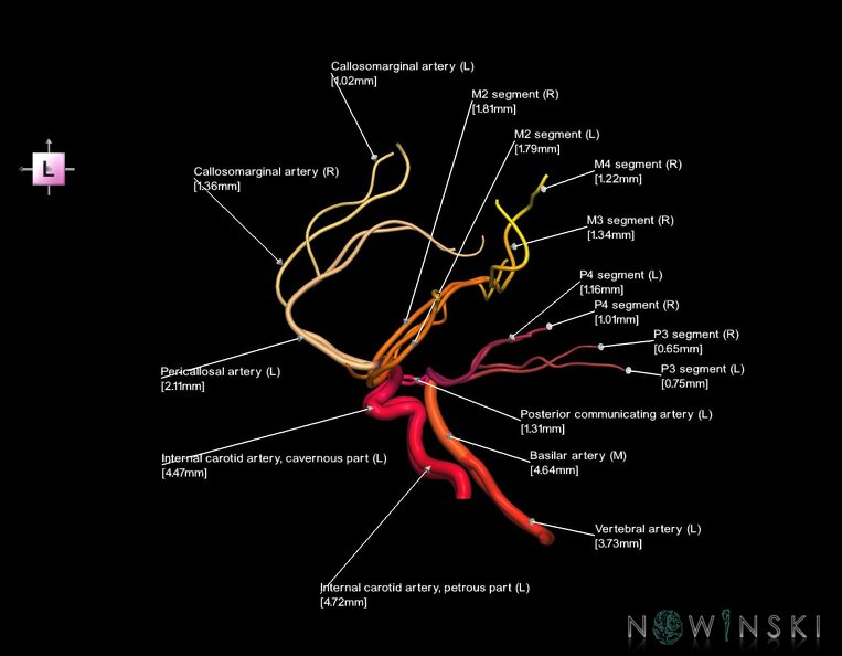 G1.T15.1.V2.C2.L3.Intracranial_arterial_system_main_branches.tiff