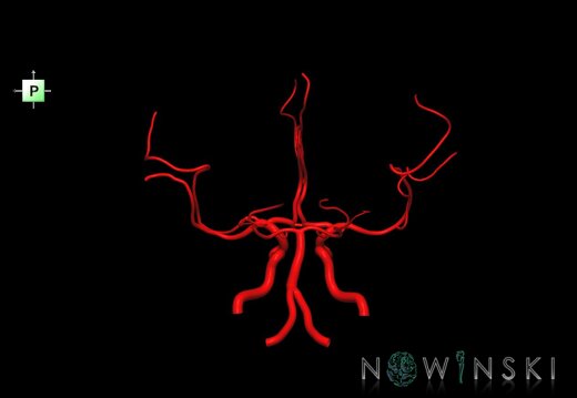 G1.T15.1.V3.C1.L0.Intracranial arterial system main branches