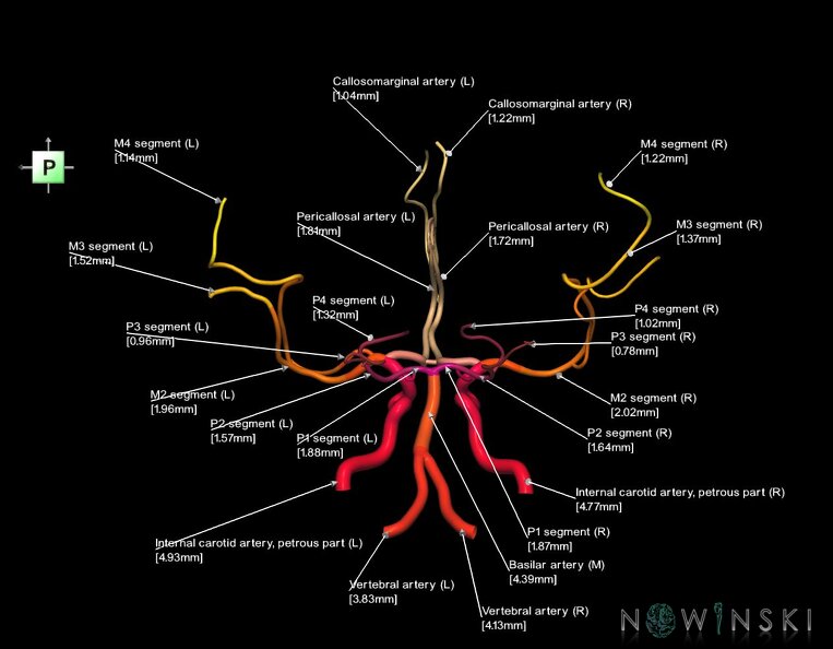G1.T15.1.V3.C2.L3.Intracranial_arterial_system_main_branches.tiff