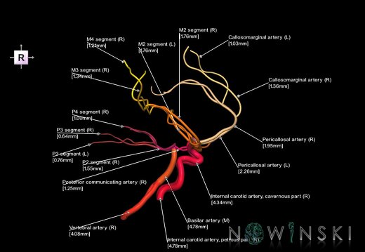 G1.T15.1.V4.C2.L3.Intracranial arterial system main branches