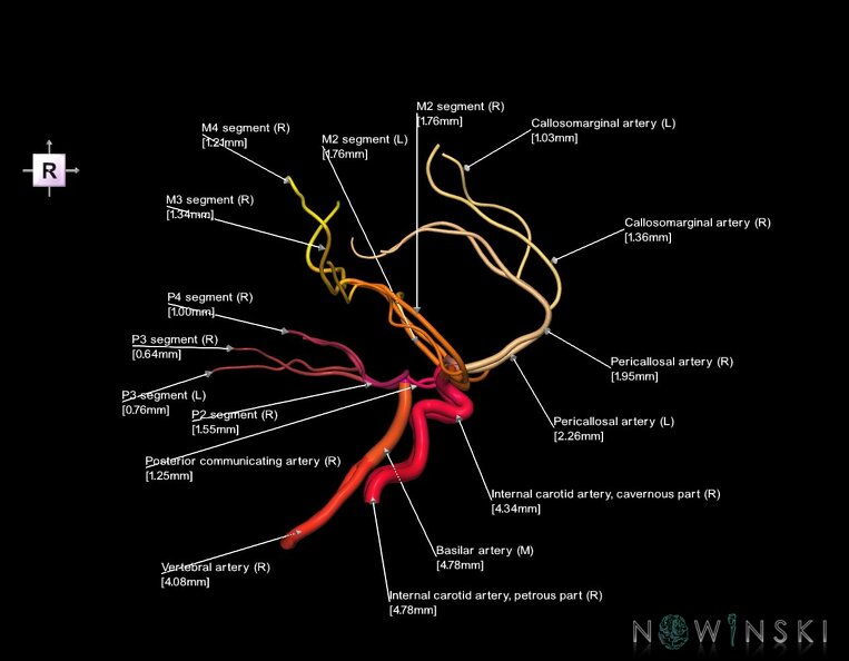 G1.T15.1.V4.C2.L3.Intracranial_arterial_system_main_branches.tiff