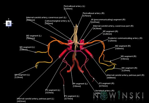 G1.T15.1.V5.C2.L3.Intracranial arterial system main branches