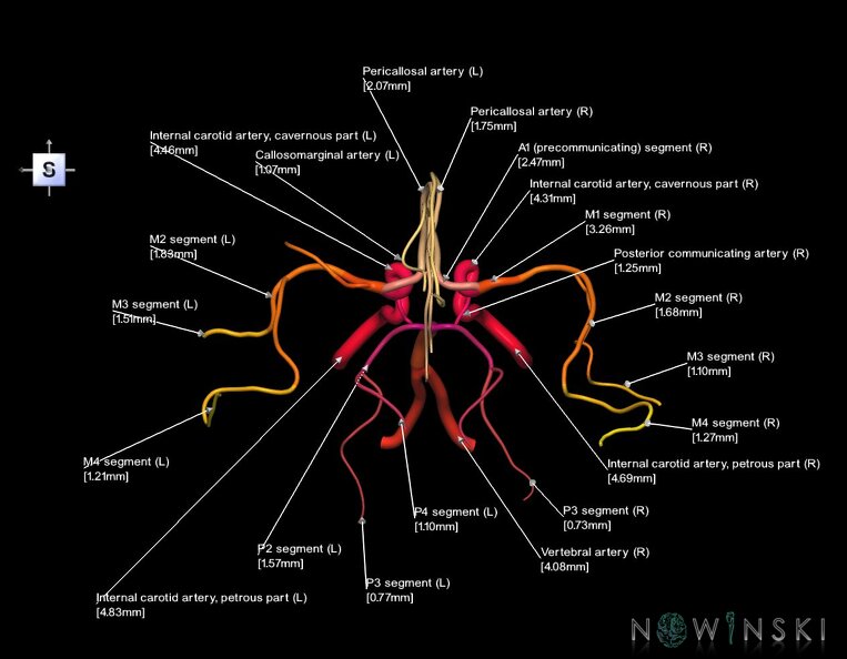 G1.T15.1.V5.C2.L3.Intracranial_arterial_system_main_branches.tiff